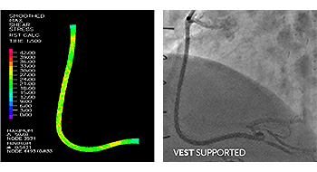 VGS-Vascular Graft Solutions