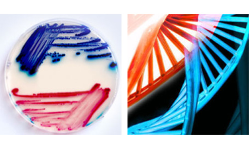 IVD, Microbiology