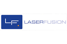 Laser Fusion