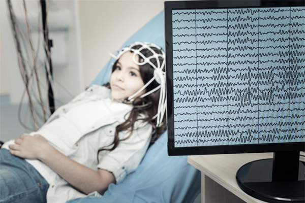 EEG Diagnostic Technology